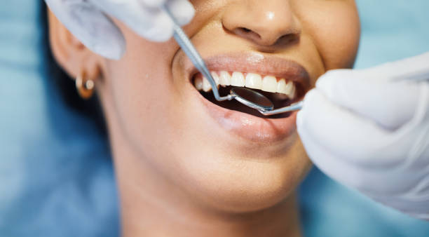 Best Emergency Tooth Extraction in Cortland, IL